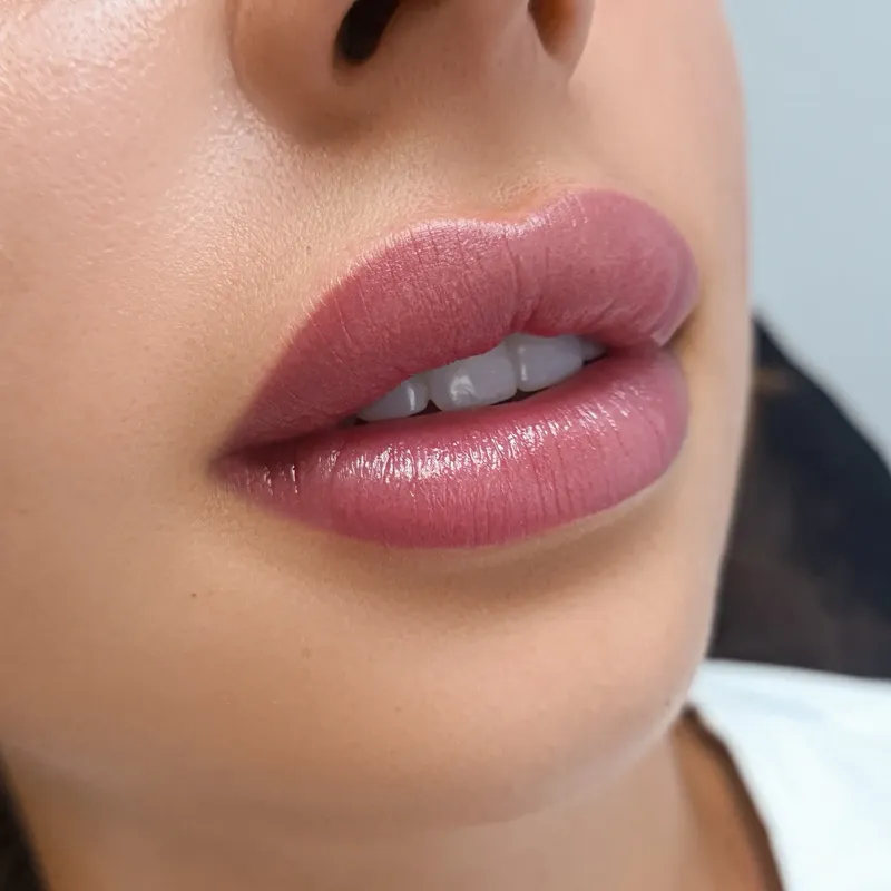 f5e4dd25 3c88 4a76 ba80 e1fe0bd265c7